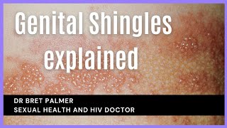 Unraveling the Mystery of Genital Shingles: What You Need to Know!