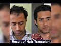 Monjoven hair transplant & cosmetic Surgery clinic 8011002870