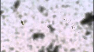 水田:ミドリムシA Euglena from a paddy field