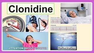 clonidine