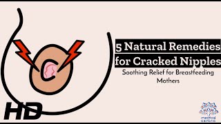 Natural Remedies for Healing Cracked Nipples