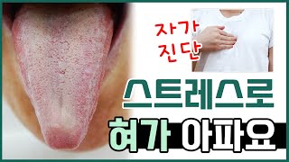 스트레스를 크게 받은 다음 혀가 아려요. 요즘 컨디션이 막 떨어져요