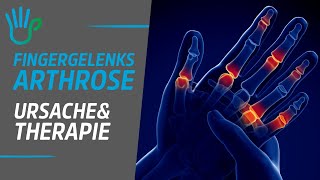 Fingergelenksarthrose - Ursache, Therapie \u0026 Übungen