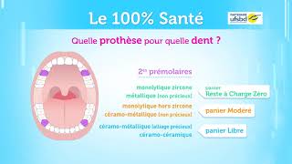 100% Santé Dentaire - Reste à Charge 0 Dentaire - RAC0