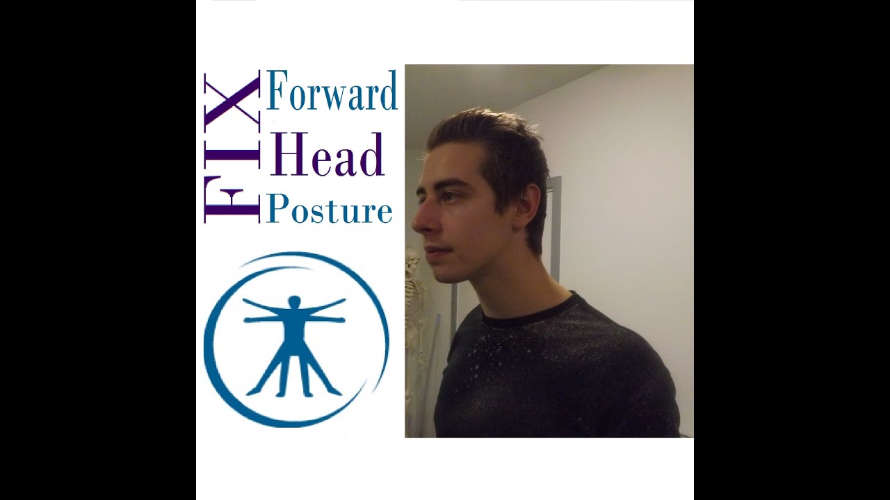 FIX Forward Head Posture With Correction Exercises - YouTube