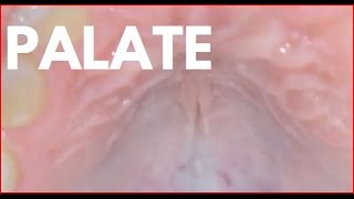 Palate. (Hard Palate)