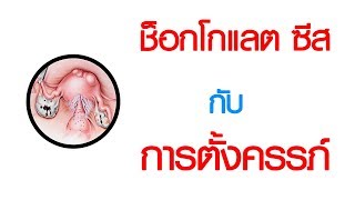 พบหมอเสรี ตอนที่ 572 : ช็อกโกแลต ซีส กับการตั้งครรภ์