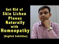 How to Get Rid of Skin Lichen Planus Naturally with Homeopathy & Home Remedies & Diet Tips