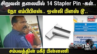 சிறுவன் தலையில் 14 Stapler Pin -கள்.. நோ எம்பிபிஎஸ்.. ஒன்லி பிளஸ் டூ.. சம்பவத்தின் பகீர் பின்னணி