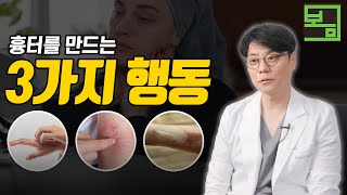 상처가 흉터가 되는 3가지 행동 (꼭 피하셔야 합니다)