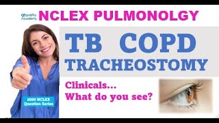 NCLEX QUESTIONS and Answers, PNEUMONIA, COPD, CHEST PAIN, ASTHMA, TB, Nursing SYMPTOMS, NCLEX Review