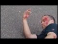 skateboard fail compilation  2016- broken bones and bleeding.