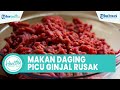 Bahaya Banyak Konsumsi Daging Bisa Picu Ginjal Rusak, Ini Kebiasaan Buruk yang Perlu Dihindari