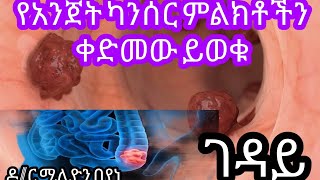 የትልቁ አንጀት ካንሰር ህመም ምልክቶች በዝህ መንገድ በቤታችሁ ለዩ/BCA of colon cancer/