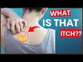 Notalgia Paresthetica (“Itchy Back”) & Causes, Symptoms, & Tips For Treatment