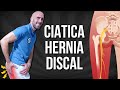 6 EJERCICIOS para la CIATICA POR HERNIA DISCAL #fisioterapiatualcance