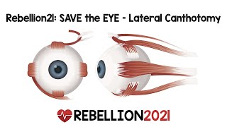 Rebellion21: SAVE the EYE – Lateral Canthotomy via Andy Little, DO