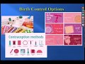 Contraception Options 1/30/19