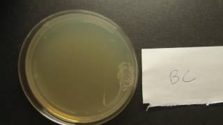 Bacillus cereus-TSA