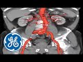 Body of Knowledge: New Machine Can See Bones, Organs in Stunning Detail | GE Healthcare