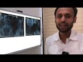 degenerative spine muscle pain मणके झिजणे खडडे पडणे मान कंबर दुखी