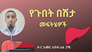 How to diagnose and treat acute hepatitis? የጉበት ወይም የወፍ በሽታ እንዴት ይታከማል?