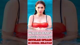 TERBARU!!! Potret wajah Angel Karamoy setelah oplas di Korea Selatan #shorts