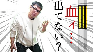 血ィ出てない？