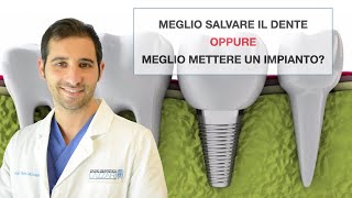 Meglio salvare il dente o meglio mettere un impianto?