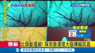 大腦連接電腦發訊號？馬斯克研發\