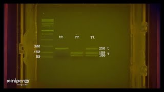 How to interpret your PTC Taster Lab gel electrophoresis results