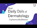 Erythema Multiforme - Daily Do's of Dermatology