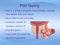 understanding the prostate and prostate conditions