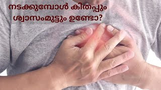 നടക്കുമ്പോള്‍ കിതപ്പും ശ്വാസമെടുക്കാന്‍ ബുദ്ധിമുട്ടും ഉണ്ടെങ്കില്‍ ഉടന്‍ ഡോക്ടറെ കാണുക