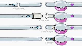 How Does Birth Control Work?