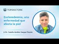 Esclerodermia, una enfermedad que afecta la piel