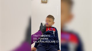 😛 Impostazione del fonema palato alveolare /ci/