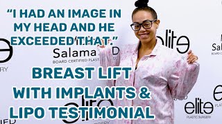 Breast Lift with Implants and Liposuction Testimonial | Dr. Moises Salama