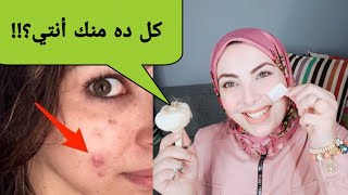 ماذا يحدث عند تدليك الوجه بفص من الثوم مرة واحدة يوميا لن تصدقي ما سيحدث !