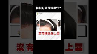 頭髮稀疏 該植髮還是紋髮？｜毛爵生髮診所