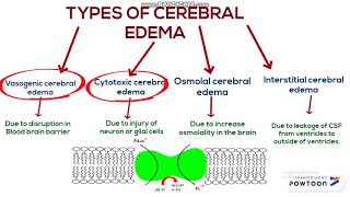 Cerebral edema