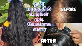 பாட்டி வைத்தியம்✅ஒரே மாதத்தில் உங்கள் தலைமுடி வளர  இந்த பொருள் போதும்👆Sana Tamil