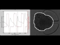 Swelling Image | Microfluidic systems for treatment screening under controlled hypoxia