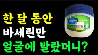 바세린의 놀라운 효능 이런 분 꼭 바세린 쓰세요! 바세린 쓰면 안 되는 경우도 알아두세요! / 초간단 상추 레시피 / 상추의 힘 / 만성염증 / 책읽어주는여자 / 오디오북