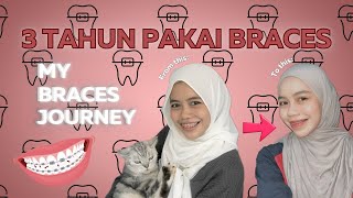 #7 Dah 3 tahun pakai braces kerajaan | My braces journey