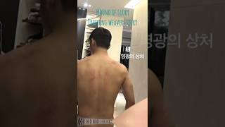 Taehyung shows his wounds from massage at weekend from military #youtubeshorts #shorts #viral #bts