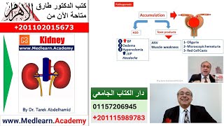 Acute glomerulonephritis (AGN)   #cme #internal_medicine  #usmle #medical #محاضرات_باطنة