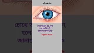 চোখে অঞ্জনি হয় কেন, হলে করণীয় কী, জানালেন চিকিৎসক #লাইফস্টাইল #lifestyle