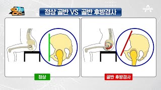 무심코 넘긴 나쁜 자세의 역습! 틀어진 골반 확인하기 | 나는 몸신이다 279 회