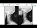 Why Chiropractors Take X-Rays